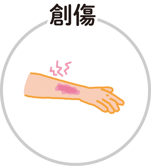 創傷